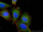 PPM1D Antibody in Immunocytochemistry (ICC/IF)