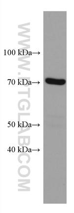 PPM1D Antibody in Western Blot (WB)