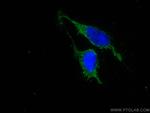 MESDC2 Antibody in Immunocytochemistry (ICC/IF)