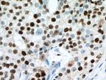 MCM7 Antibody in Immunohistochemistry (Paraffin) (IHC (P))