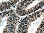 c-MYC Antibody in Immunohistochemistry (Paraffin) (IHC (P))