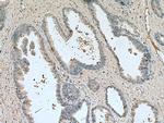 TAOK3 Antibody in Immunohistochemistry (Paraffin) (IHC (P))