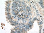 TAOK3 Antibody in Immunohistochemistry (Paraffin) (IHC (P))