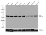 CCT4 Antibody in Western Blot (WB)