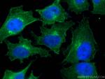 CEP55 Antibody in Immunocytochemistry (ICC/IF)
