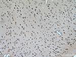SLC25A12 Antibody in Immunohistochemistry (Paraffin) (IHC (P))