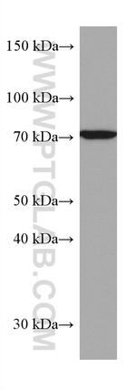 SLC25A12 Antibody in Western Blot (WB)