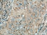MGME1 Antibody in Immunohistochemistry (Paraffin) (IHC (P))