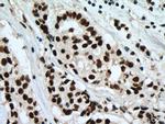 SF3B3 Antibody in Immunohistochemistry (Paraffin) (IHC (P))