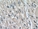 PGAM1 Antibody in Immunohistochemistry (Paraffin) (IHC (P))