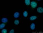 MGMT Antibody in Immunocytochemistry (ICC/IF)
