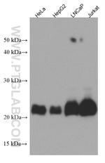 MGMT Antibody in Western Blot (WB)