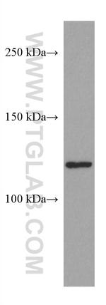 ERAP2 Antibody in Western Blot (WB)