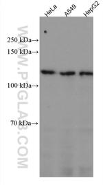 ERAP2 Antibody in Western Blot (WB)