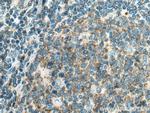 PIP5K1A Antibody in Immunohistochemistry (Paraffin) (IHC (P))