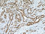 S100P Antibody in Immunohistochemistry (Paraffin) (IHC (P))