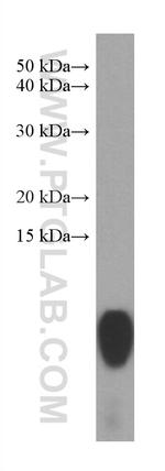 S100P Antibody in Western Blot (WB)