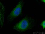 HRD1/SYVN1 Antibody in Immunocytochemistry (ICC/IF)