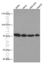 HRD1/SYVN1 Antibody in Western Blot (WB)