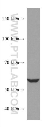 NR2C2 Antibody in Western Blot (WB)