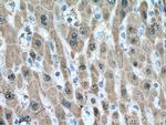 UNG Antibody in Immunohistochemistry (Paraffin) (IHC (P))