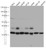UNG Antibody in Western Blot (WB)