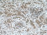PRKACA Antibody in Immunohistochemistry (Paraffin) (IHC (P))
