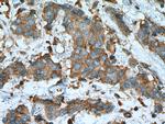 PRKACA Antibody in Immunohistochemistry (Paraffin) (IHC (P))