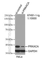 PRKACA Antibody in Western Blot (WB)