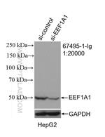 EEF1A1 Antibody in Western Blot (WB)