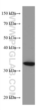 AKR1B1 Antibody in Western Blot (WB)