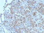 BRCA2 (Breast Marker) Monoclonal Antibody (BRCA2/2158)