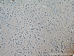 RAB2A Antibody in Immunohistochemistry (Paraffin) (IHC (P))