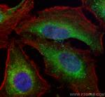 RHOBTB3 Antibody in Immunocytochemistry (ICC/IF)