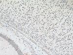RHOBTB3 Antibody in Immunohistochemistry (Paraffin) (IHC (P))