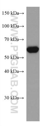 RHOBTB3 Antibody in Western Blot (WB)