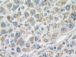 ACO2 Antibody in Immunohistochemistry (Paraffin) (IHC (P))
