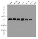 HPRT1 Antibody in Western Blot (WB)