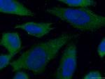 CMPK1 Antibody in Immunocytochemistry (ICC/IF)