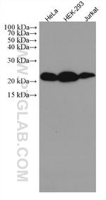 CMPK1 Antibody in Western Blot (WB)