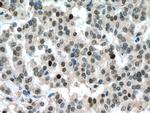 RB1 Antibody in Immunohistochemistry (Paraffin) (IHC (P))