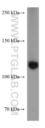 RB1 Antibody in Western Blot (WB)