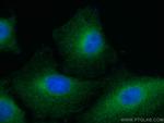 FES Antibody in Immunocytochemistry (ICC/IF)