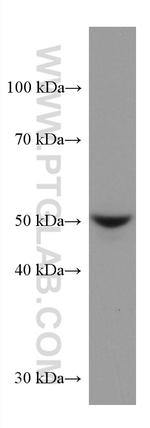STK32A Antibody in Western Blot (WB)