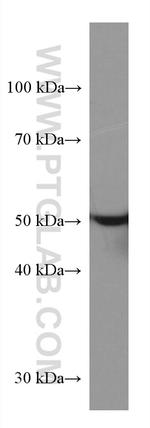 STK32A Antibody in Western Blot (WB)