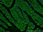 MYL4 Antibody in Immunohistochemistry (Paraffin) (IHC (P))