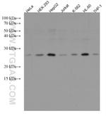 RAB8A Antibody in Western Blot (WB)