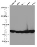 CCT7 Antibody in Western Blot (WB)
