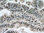 RBM8A/Y14 Antibody in Immunohistochemistry (Paraffin) (IHC (P))