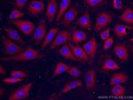 RHOC Antibody in Immunocytochemistry (ICC/IF)